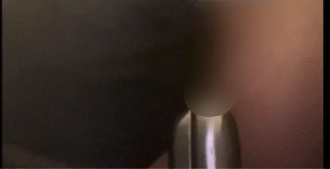 Mit dem Spekulum steht mein Loch weit offen - Lola84foryou Anal Video