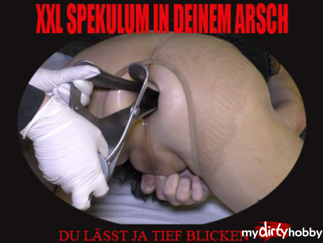 XXL SPEKULUM IN DER ARSCHFOTZE